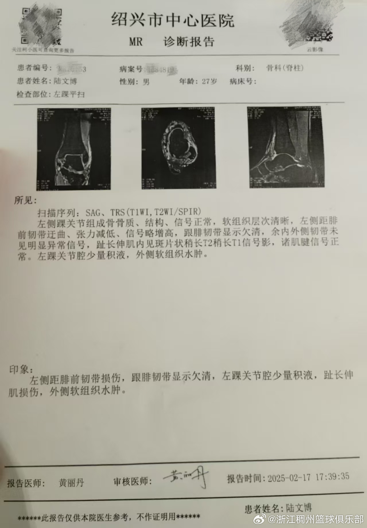 直接影响了